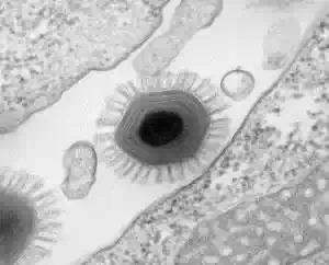 world largest virus